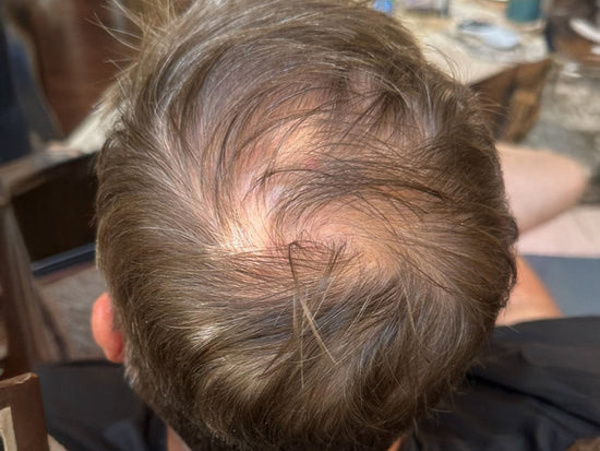 Xtressé™ Hair Growth Gummy